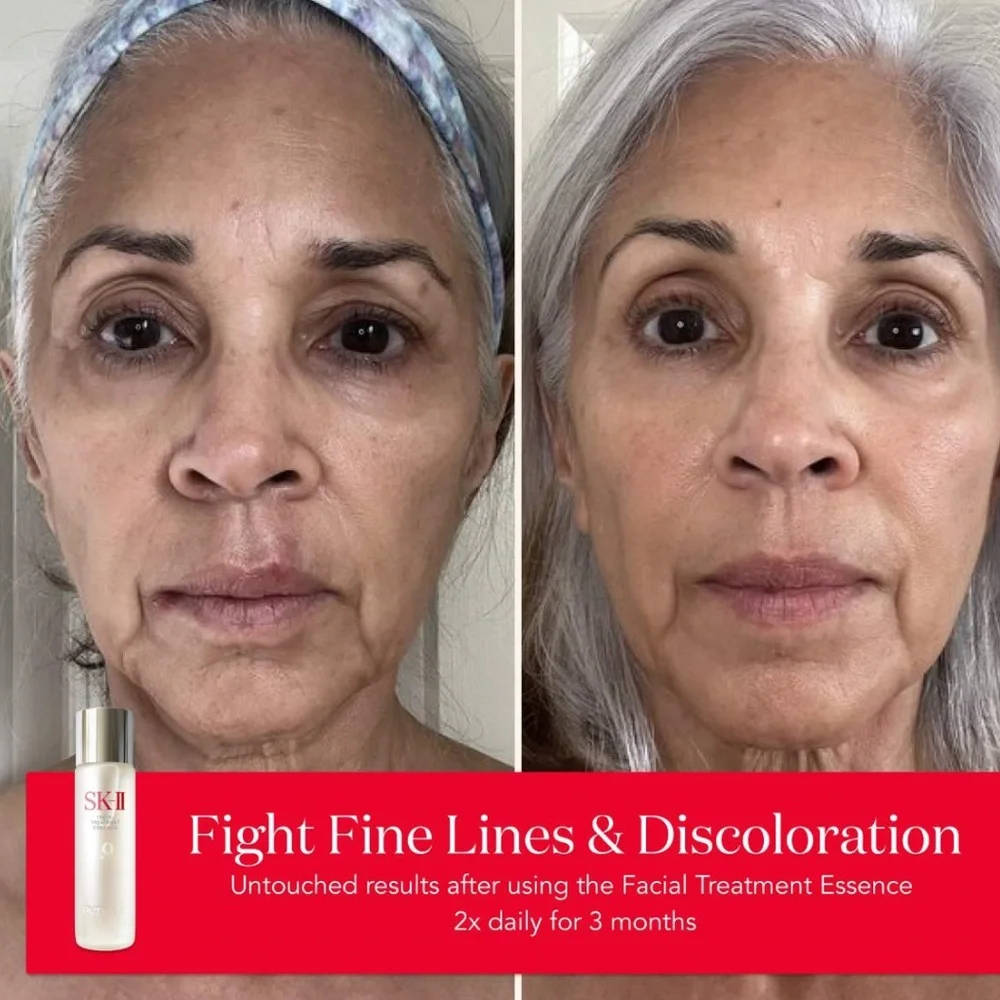 Facial Treatment Essence Anti-Aging‎ Toner in VIP Box